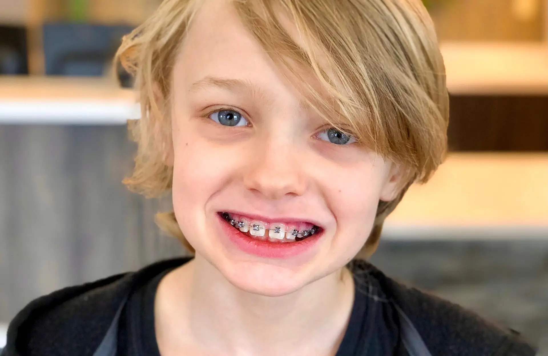 Smiling boy with braces