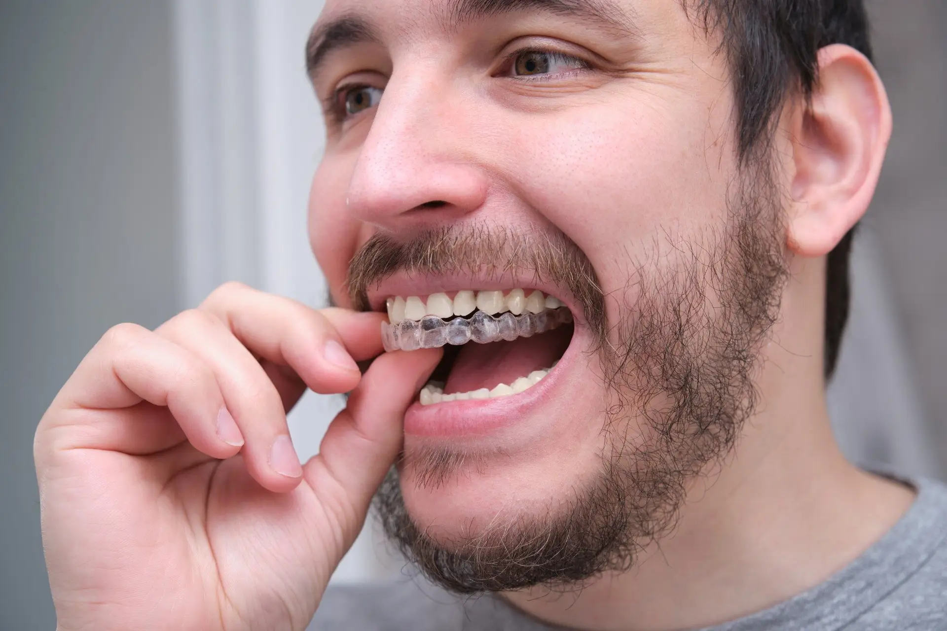 Smiling man putting in his clear aligner