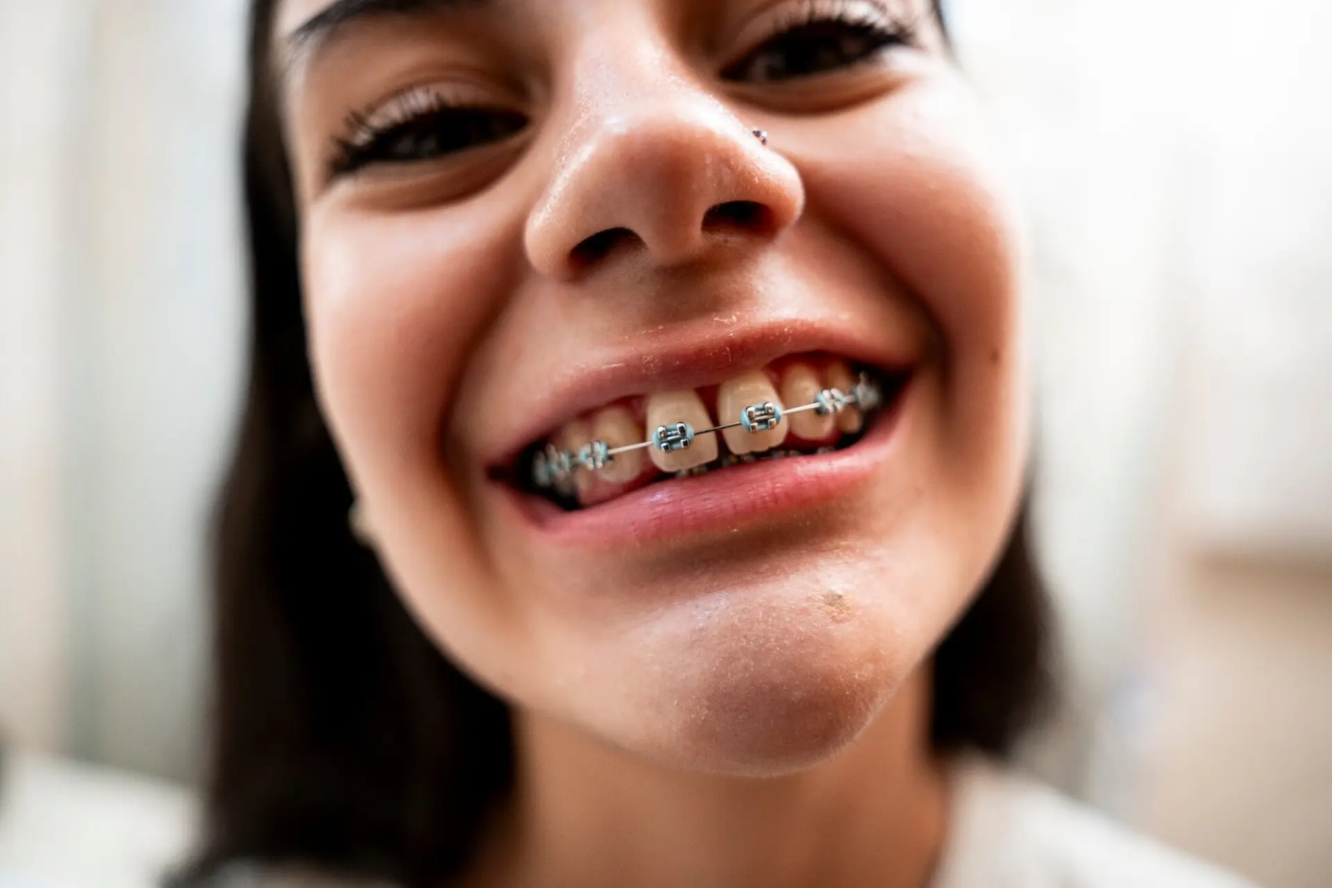 Close-up of a teen smiling with braces