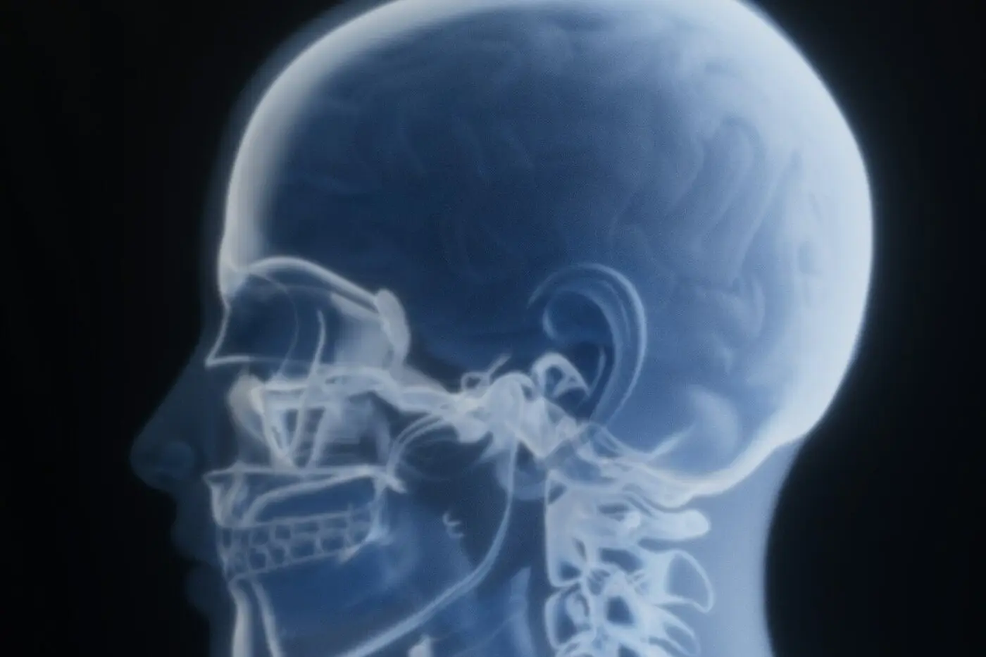 Side-view X-ray of the head, jaw, and neck